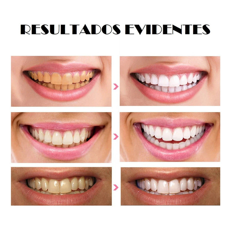 Blanqueador Dental Pasta Dental Pasta Blanqueamiento Dental