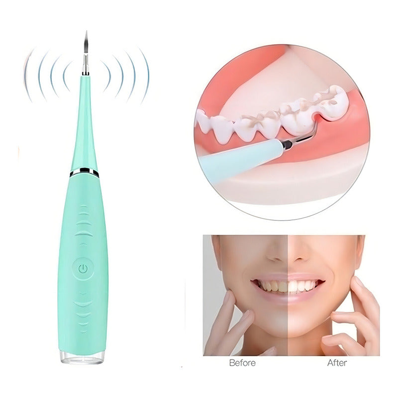 Limpiador De Dientes Quita Sarro Raspador Dental Ultrasónico