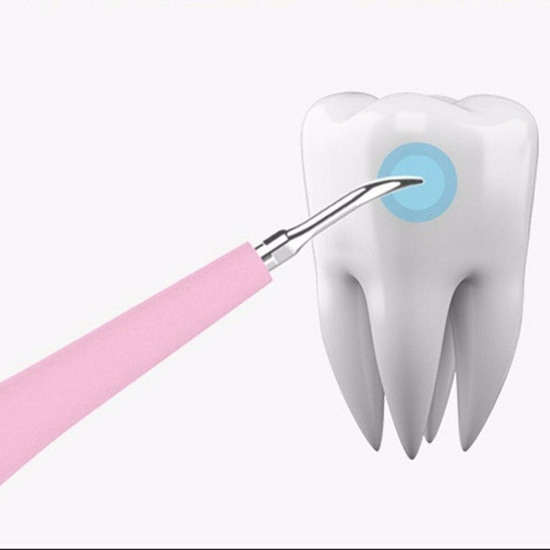 Eliminador De Sarro Dental Removedor De Sarro Usb Quita Saca