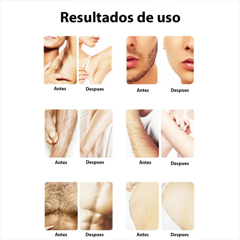 Cera Depilatoria Elástica 200g Cera Depilatoria Para Olla