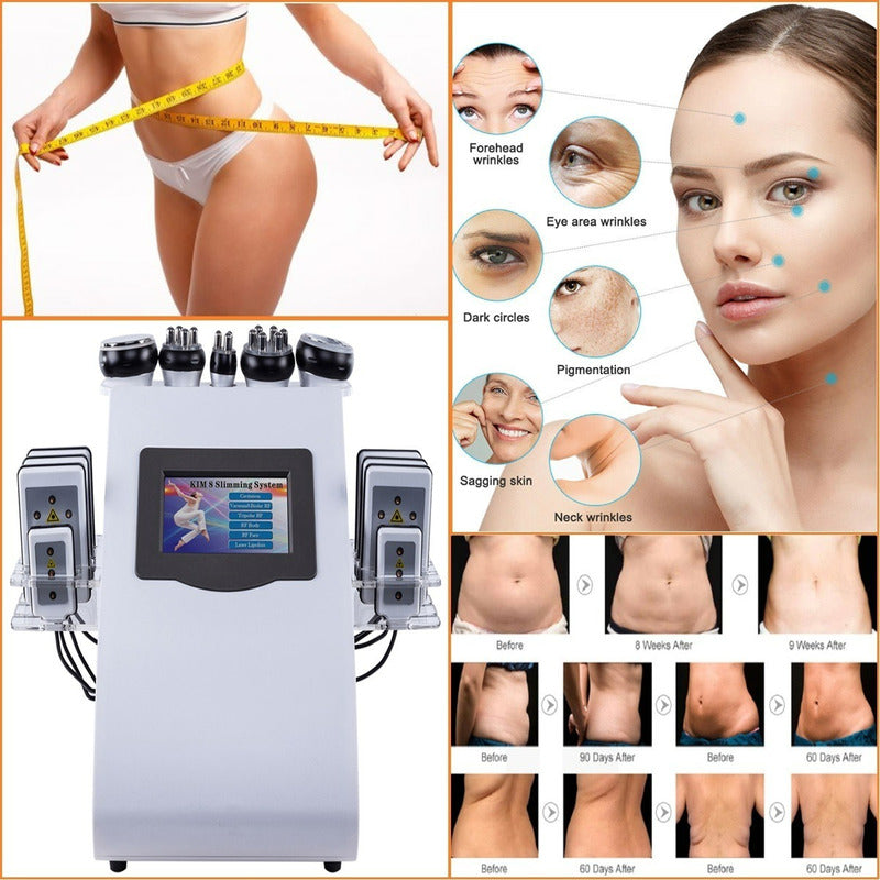 Maquina Cavitacion 6 En 1 Radiofrecuencia Facial Corporal