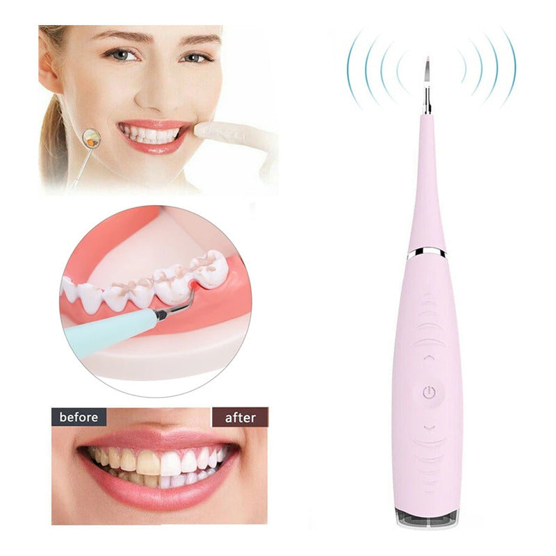Eliminador De Sarro Dental Removedor De Sarro Usb Quita Saca